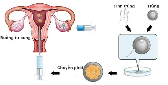 Thế Nào Là Thụ Tinh Trong? Tìm Hiểu Chi Tiết Về Quá Trình Thụ Tinh